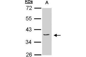 Image no. 1 for anti-Eukaryotic Translation Initiation Factor 3, Subunit M (EIF3M) (C-Term) antibody (ABIN2856365)