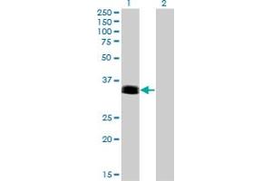 anti-PHOX2A antibody (AA 1-90) | Product No. ABIN559952