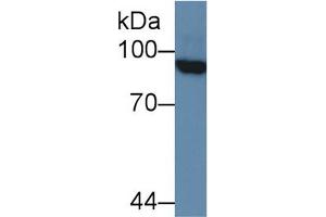Image no. 1 for Promyelocytic Leukemia (PML) ELISA Kit (ABIN6720583)