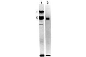 Image no. 1 for anti-Laminin, gamma 1 (LAMC1) antibody (ABIN108417)