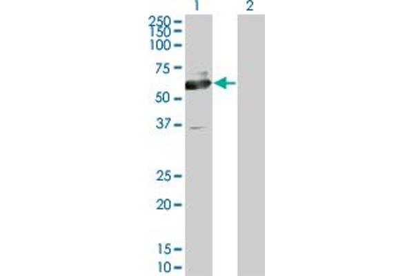 anti-ACC Synthase-Like Protein 1 (ACCS) (AA 1-100) antibody