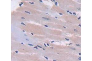 Image no. 3 for anti-Nephroblastoma Overexpressed (NOV) (AA 156-351) antibody (ABIN5013995)