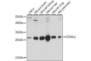 CD99L2 antibody  (AA 26-185)
