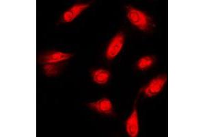 Immunofluorescent analysis of c-FER staining in HeLa cells.
