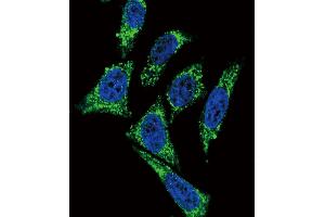 Image no. 1 for anti-Midkine (Neurite Growth-Promoting Factor 2) (MDK) (AA 113-143), (C-Term) antibody (ABIN5537178)