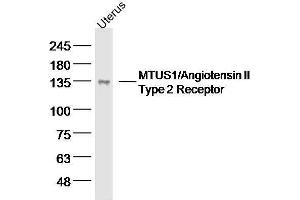 Image no. 4 for anti-Microtubule Associated Tumor Suppressor 1 (MTUS1) (AA 1180-1230) antibody (ABIN2177806)