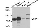 Image no. 1 for anti-Interleukin 31 Receptor A (IL31RA) antibody (ABIN2968673)