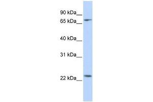 Image no. 1 for anti-Zinc Finger Protein 185 (ZNF185) (N-Term) antibody (ABIN927747)