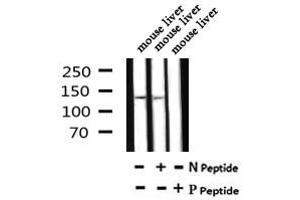 Image no. 1 for anti-ATP-Binding Cassette, Sub-Family B (MDR/TAP), Member 11 (ABCB11) (pSer690) antibody (ABIN6269603)