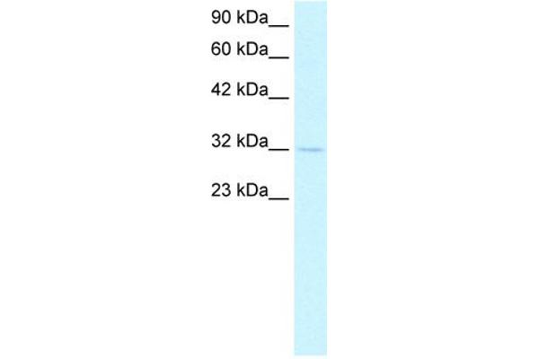 anti-Kv Channel Interacting Protein 3, Calsenilin (KCNIP3) (N-Term) antibody