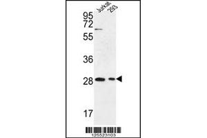 Western Blotting (WB) image for anti-Ermin, ERM-Like Protein (ERMN) (Center) antibody (ABIN2158736)