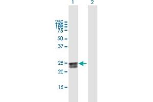 Image no. 1 for anti-HEAT Repeat Containing 2 (HEATR2) (AA 1-223) antibody (ABIN527247)