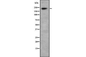 Image no. 1 for anti-Sodium Channel, Voltage-Gated, Type I, alpha Subunit (SCN1A) (Internal Region) antibody (ABIN6263501)