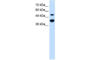 Image no. 2 for anti-Matrix Metallopeptidase 1 (Interstitial Collagenase) (MMP1) (C-Term) antibody (ABIN2777120)