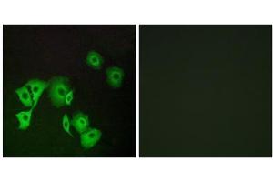 Image no. 1 for anti-Transcription Termination Factor, RNA Polymerase II (TTF2) (Internal Region) antibody (ABIN1852442)