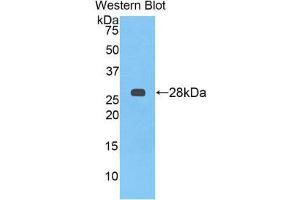 Image no. 1 for anti-alpha-2-HS-Glycoprotein (AHSG) (AA 19-250) antibody (ABIN1077779)