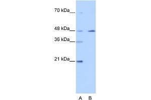 NR2F2 antibody  (N-Term)