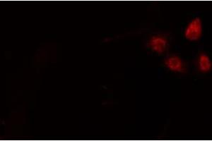 Image no. 1 for anti-Nuclear Transcription Factor Y, alpha (NFYA) antibody (ABIN6257371)