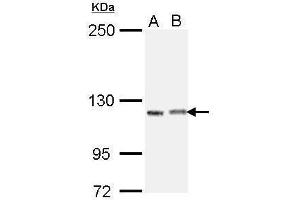 WB Image Sample (30 ug of whole cell lysate) A: H1299 B: Raji 5% SDS PAGE antibody diluted at 1:1000