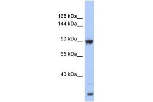 Image no. 1 for anti-Upregulator of Cell Proliferation (URGCP) (Middle Region) antibody (ABIN2786622)