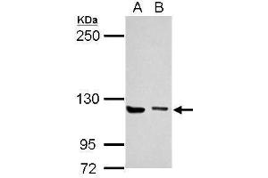 Image no. 3 for anti-Unc-13 Homolog D (UNC13D) (C-Term) antibody (ABIN2856569)