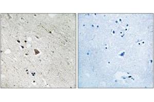 Image no. 2 for anti-Fms-Related tyrosine Kinase 3 (FLT3) (AA 935-984), (pTyr969) antibody (ABIN1532045)
