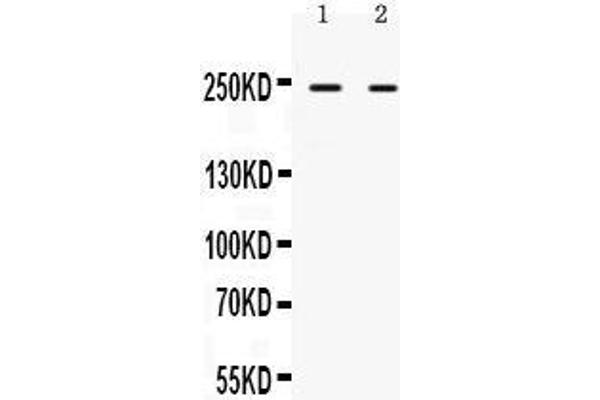 anti-AT Rich Interactive Domain 1A (SWI-Like) (ARID1A) (AA 1021-1053), (Middle Region) antibody