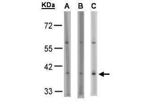 WB Image Sample(30 μg of whole cell lysate) A:HeLa S3 , B:MOLT4, C:Raji , 10% SDS PAGE antibody diluted at 1:1000