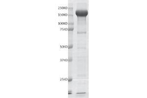 Image no. 1 for Ankyrin Repeat-Containing Protein (EHMT2) (Lys9) protein (DYKDDDDK Tag) (ABIN2669671)