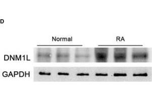Image no. 13 for anti-Glyceraldehyde-3-Phosphate Dehydrogenase (GAPDH) antibody (ABIN3020541)