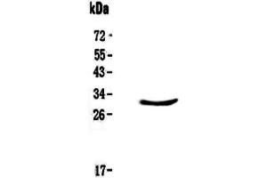 Image no. 1 for anti-ClpP Caseinolytic Peptidase, ATP-Dependent, Proteolytic Subunit Homolog (E. Coli) (CLPP) (AA 184-247) antibody (ABIN5693176)