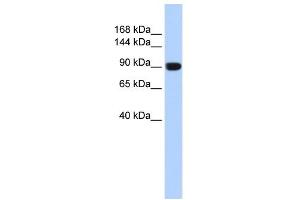 Image no. 1 for anti-Anoctamin 1, Calcium Activated Chloride Channel (ANO1) (Middle Region) antibody (ABIN2775453)