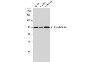 WB Image beta Catenin antibody [N1N2-2], N-term detects beta Catenin protein by western blot analysis.