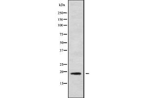 Image no. 1 for anti-Interleukin 1 Family Member 9 (IL1F9) antibody (ABIN6262547)