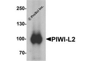 Image no. 2 for anti-Piwi-Like 2 (PIWIL2) (Middle Region) antibody (ABIN1031041)