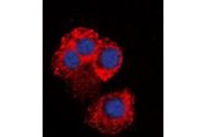 Image no. 1 for anti-Inhibitor of kappa Light Polypeptide Gene Enhancer in B-Cells, Kinase gamma (IKBKG) (Center) antibody (ABIN2972911)