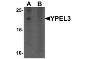 YPEL3 antibody  (N-Term)