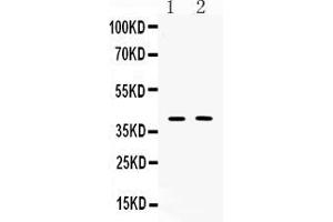 Image no. 2 for anti-ISL LIM Homeobox 1 (ISL1) (AA 118-161), (Middle Region) antibody (ABIN5518765)