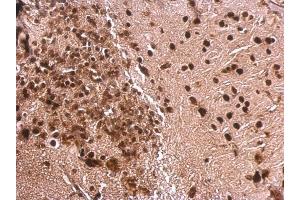 IHC-P Image MEF2A antibody [C2C3], C-term detects MEF2A protein at nucleus on mouse fore brain by immunohistochemical analysis.