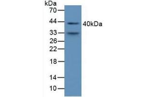 Image no. 3 for alpha 1 Microglobulin/bikunin precursor (AMBP) ELISA Kit (ABIN6574147)