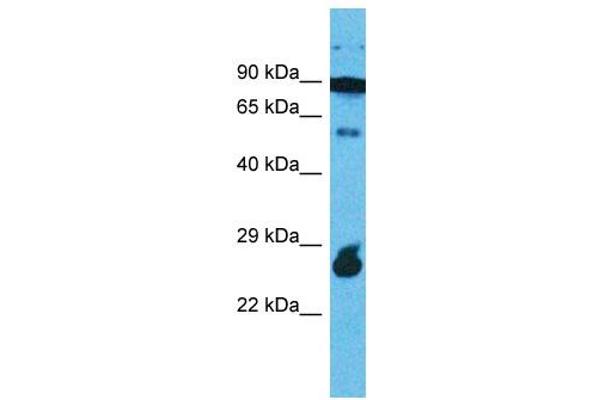 RAPGEFL1 Antikörper  (C-Term)