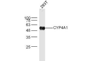Image no. 3 for anti-Cytochrome P450, Family 4, Subfamily A, Polypeptide 11 (CYP4A11) (AA 351-450) antibody (ABIN708986)