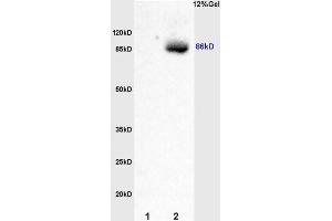 Image no. 3 for anti-Smoothened Homolog (Drosophila) (SMO) (AA 551-650) antibody (ABIN680908)