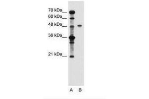 Image no. 2 for anti-Solute Carrier Family 39 (Zinc Transporter), Member 6 (SLC39A6) (AA 26-75) antibody (ABIN205014)