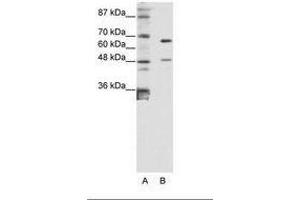 Image no. 1 for anti-Zinc Finger Protein 597 (ZNF597) (AA 48-97) antibody (ABIN6736181)