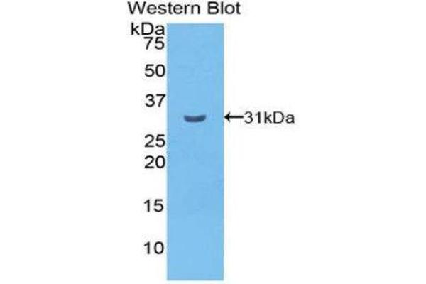 CELSR2 antibody  (AA 544-796)