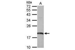 Image no. 1 for anti-ADP Ribosylation Factor Like GTPase 1 (ARL1) (AA 1-163) antibody (ABIN1496712)
