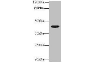 DAPK2 Antikörper  (AA 222-370)