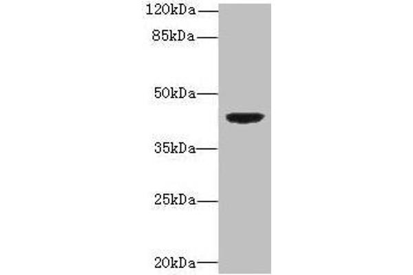 DAPK2 Antikörper  (AA 222-370)