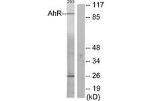 Image no. 2 for anti-Aryl Hydrocarbon Receptor (AHR) (AA 2-51) antibody (ABIN1532497)